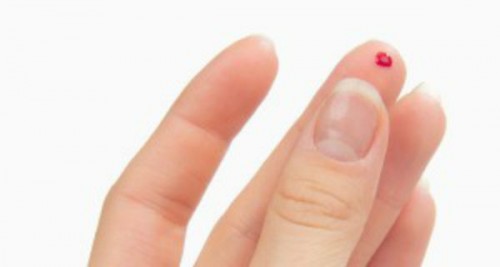 Shpëtoni Nga Goditjet Në Tru Duke Përdorur Vetëm Një Gjilpërë Gazeta