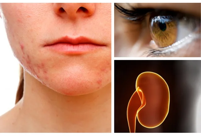 stresi, organe, shendeti